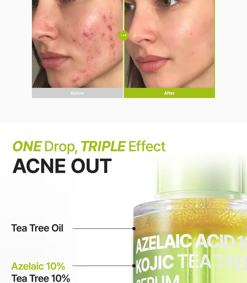 Purito Azelaic Acid 10% + Kojic + Tea Tree Serum 30ml thumbnail